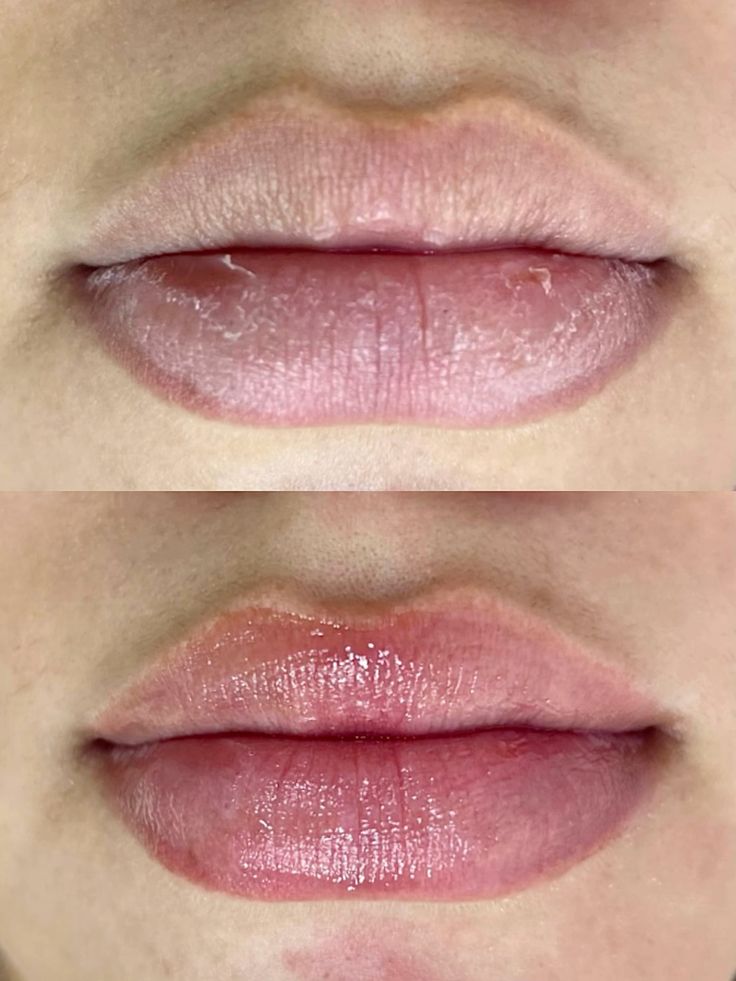 Resultado Lábios com Henna